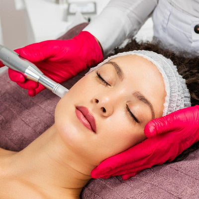 La sottile arte del microneedling a radiofrequenza: Il nemico delle rughe
