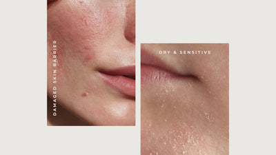 Skin Inflammation: The Root Cause of Aging, Sensitivity and Skin Damage